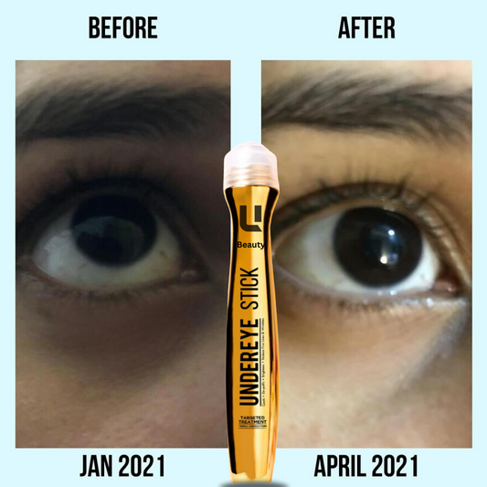 ANTI DARK CIRCLE SERUM