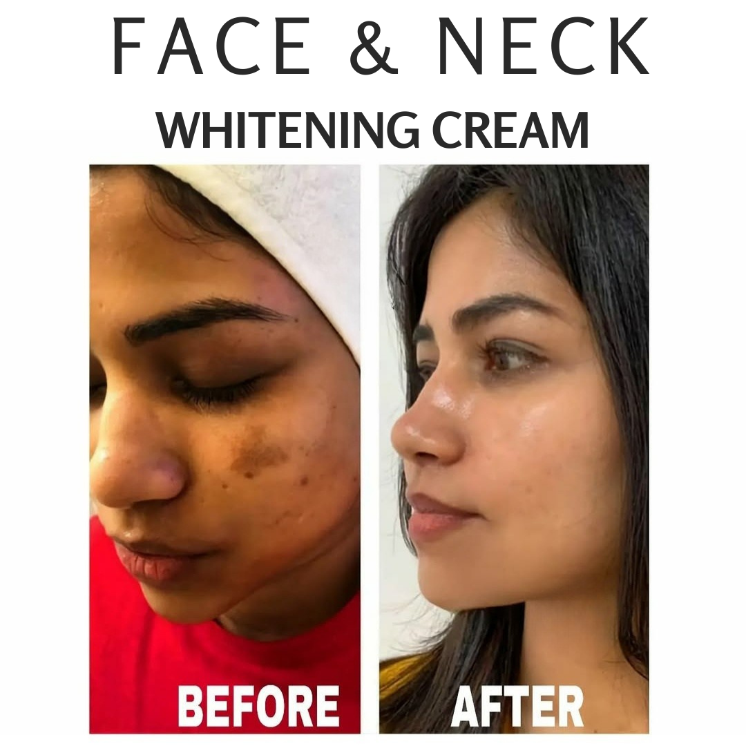 FACE NECK WHITENING CREAM
