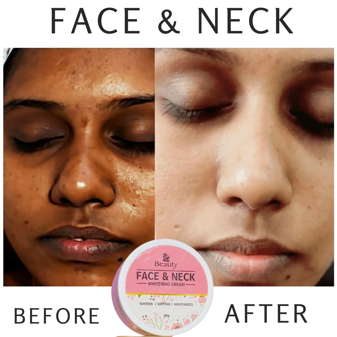 FACE NECK WHITENING CREAM