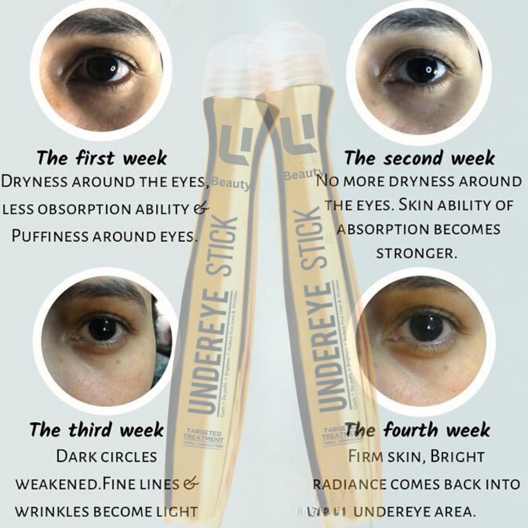 ANTI DARK CIRCLE SERUM