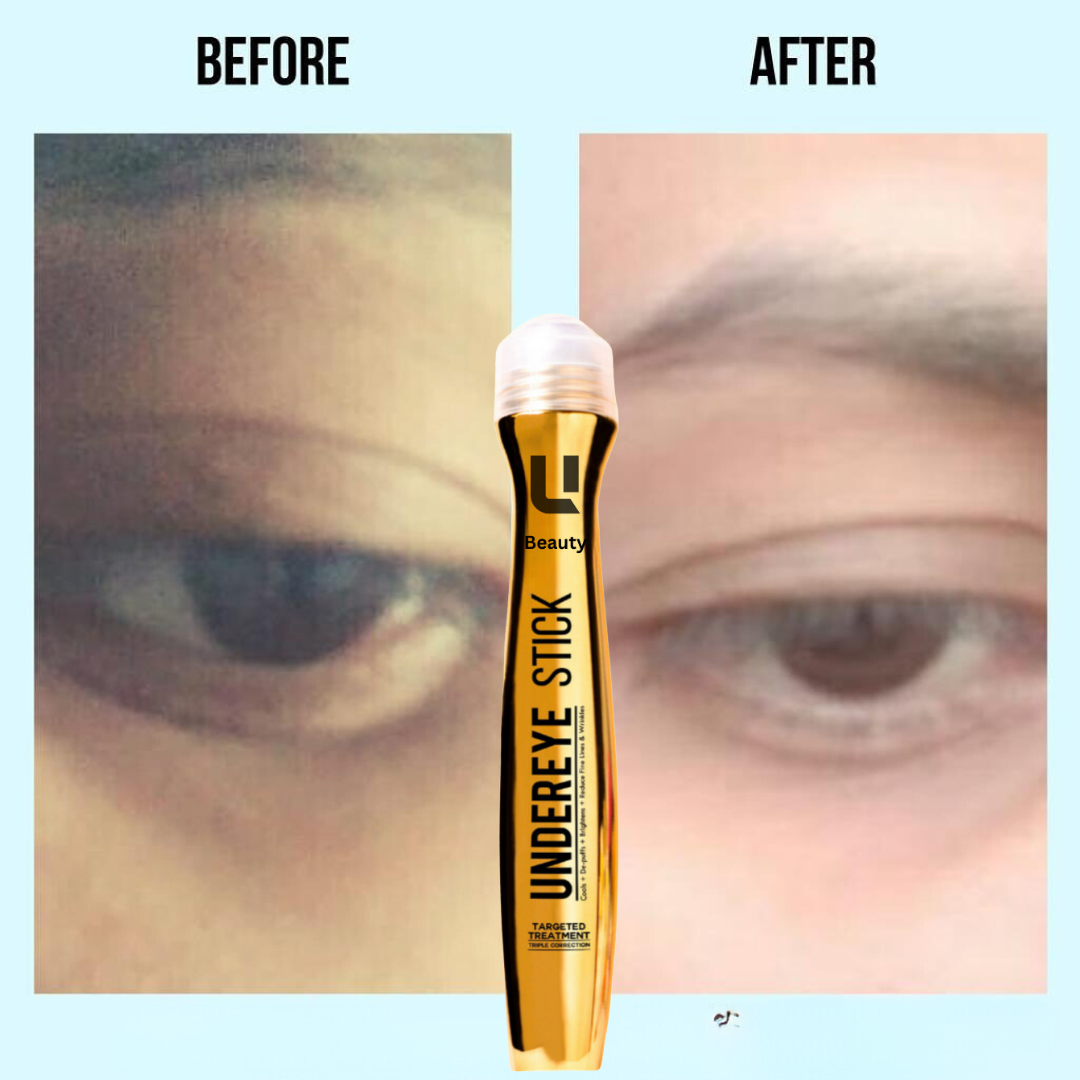 ANTI DARK CIRCLE SERUM