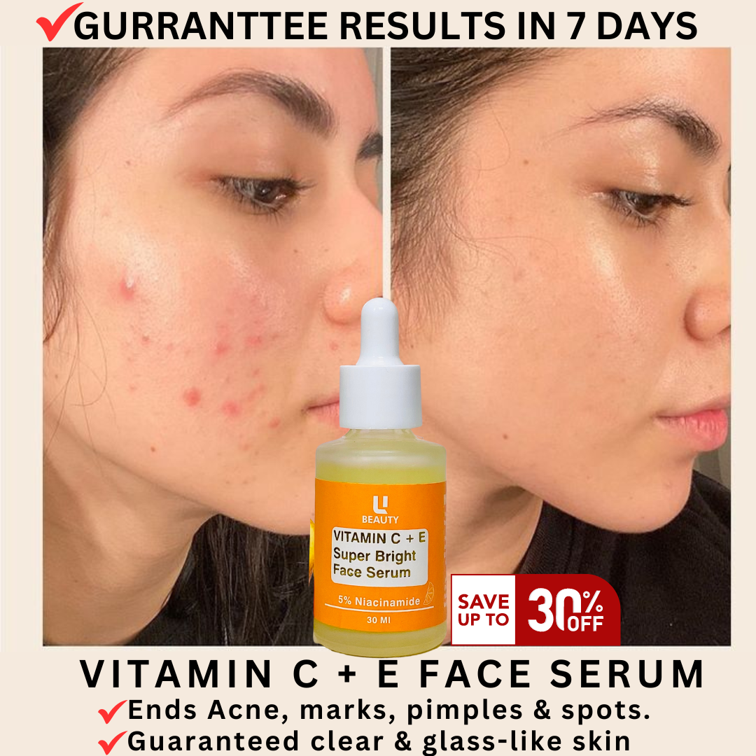 ANTI ACNE & GLOWING SERUM VITAMIN C + E